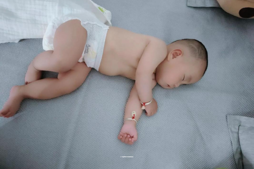 新昌六个月宝宝眼睛散光
